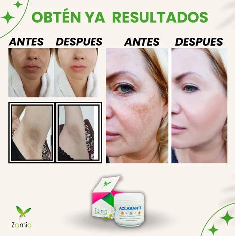 Zamia Glow™:“Crema aclarante de manchas “Fórmula Natural con Ácido Kójico, Vitamina C, Vitamina E, Caléndula y Ácido Glicólico”🌿 🌸