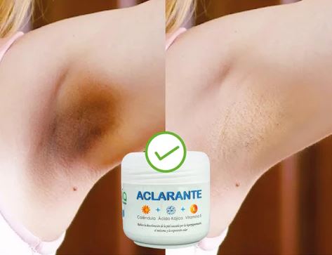Zamia Glow™:“Crema aclarante de manchas “Fórmula Natural con Ácido Kójico, Vitamina C, Vitamina E, Caléndula y Ácido Glicólico”🌿 🌸