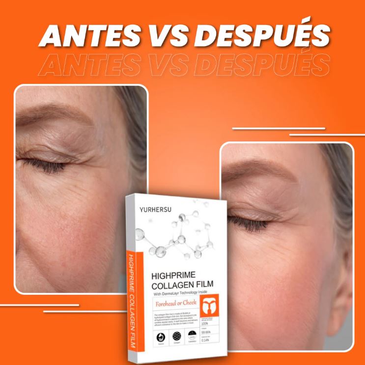 Piel Eterna™:Parches de Colágeno con Ácido Hialurónico🌸💎