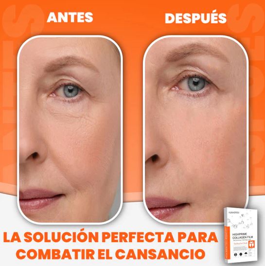 Piel Eterna™:Parches de Colágeno con Ácido Hialurónico🌸💎