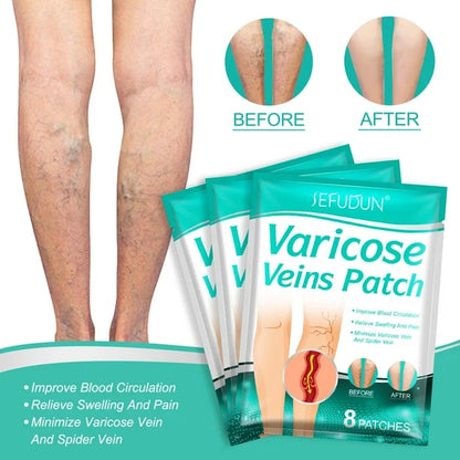 PACK DE 3 PARCHES PARA VARICES, Vuelve a usar tus shorts sin miedo😎💃 (24 PARCHES)